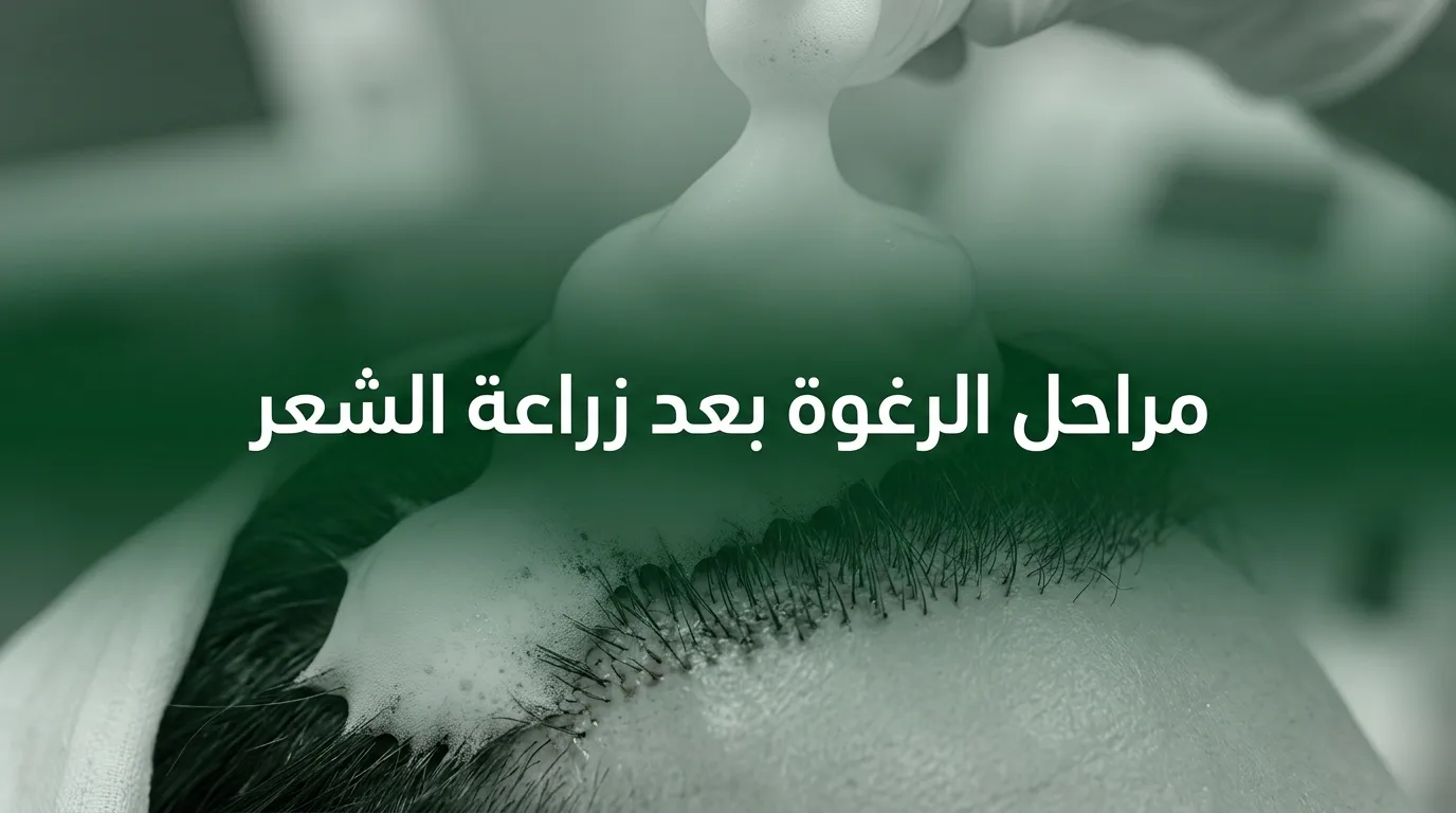 مراحل الرغوة بعد زراعة الشعر